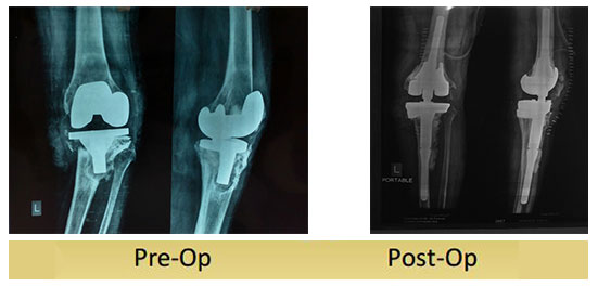 case-study4