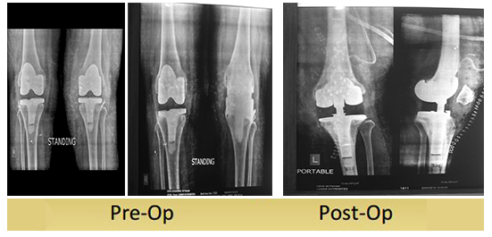 case-study46