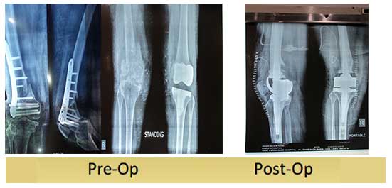 case-study4120