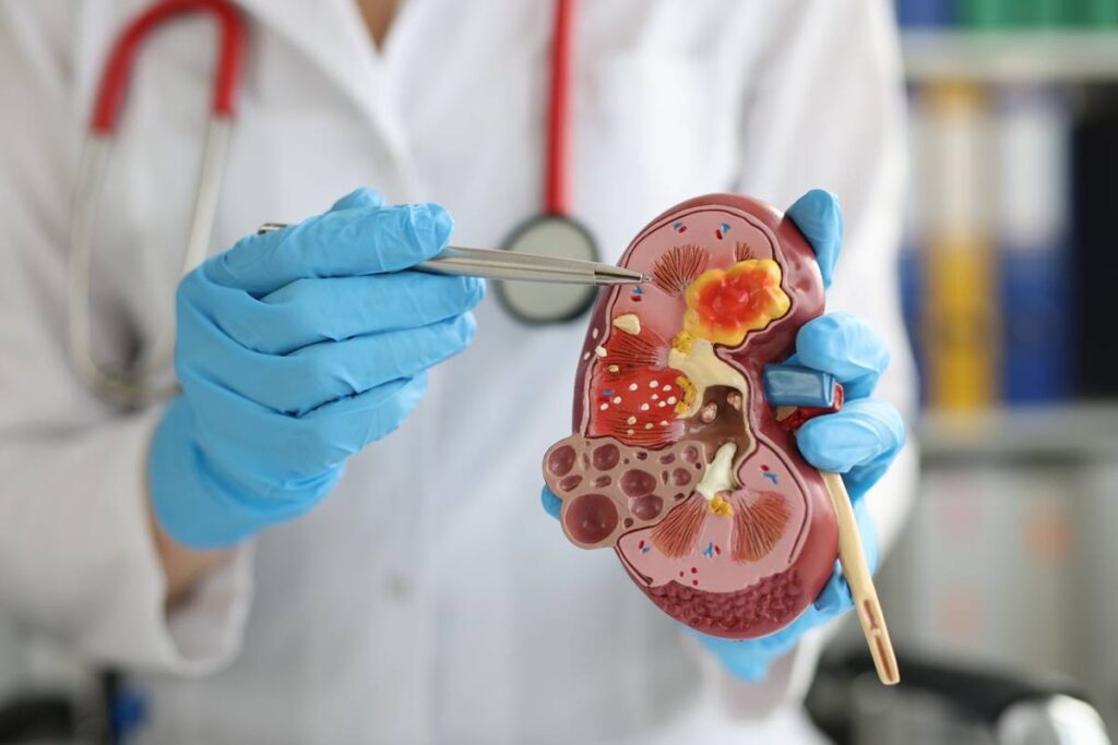 Best Kidney Specialist in Delhi NCR