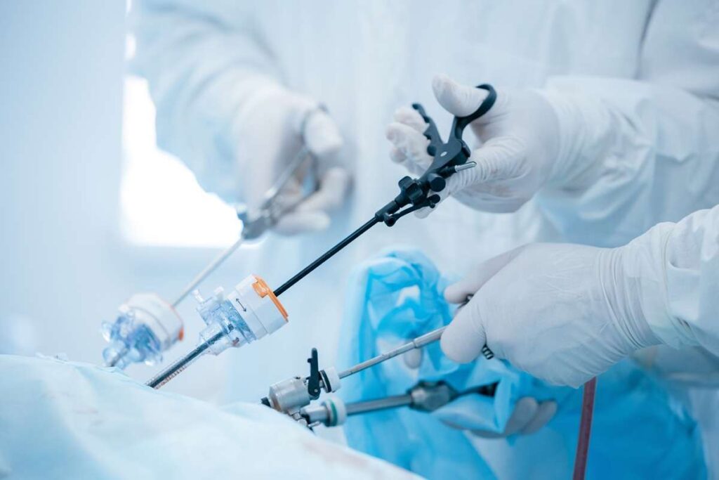 Laparoscopic Surgery